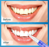 Remove Tooth Stains